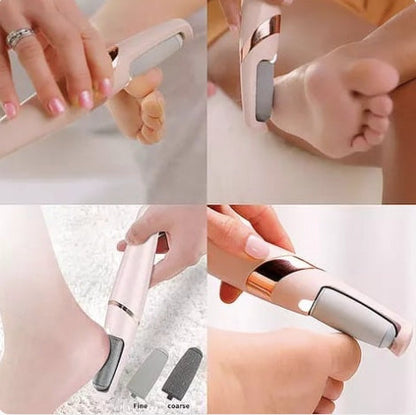 SuavePies – Elimina grietas y callos en minutos